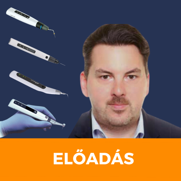 Előadás