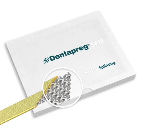 SFM_surface-retained-splint_fiber-composites5